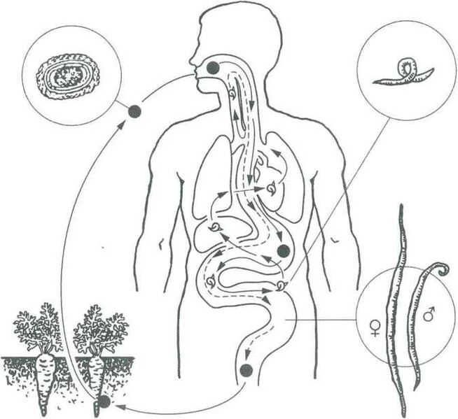 Die Hauptformen der Durchdringung von Parasiten im menschlichen Körper