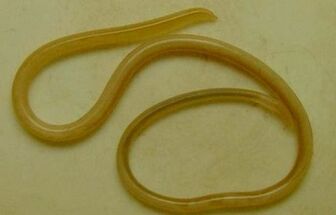 Arten von Parasiten im menschlichen Körper