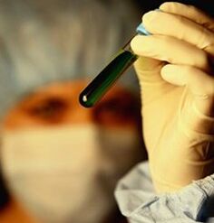 wie man sich auf Parasiten testen lässt