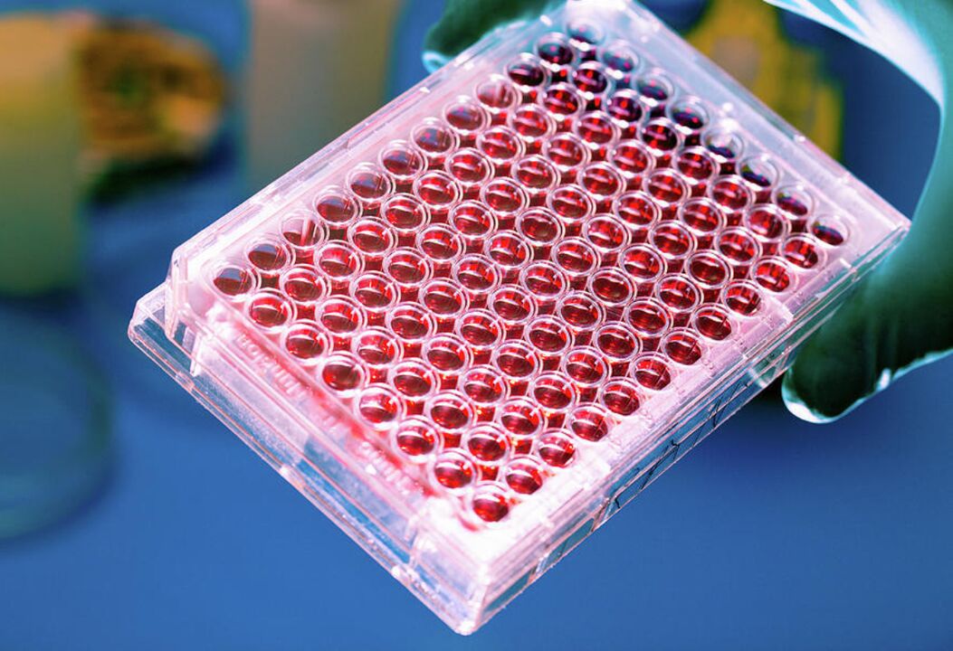 Bluttest auf Parasiten