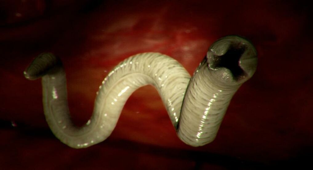 Wurm des menschlichen Körpers