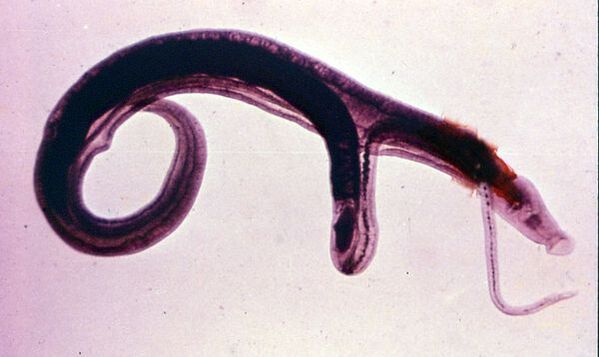 Schistosomen gehören zu den häufigsten und gefährlichsten Parasiten. 